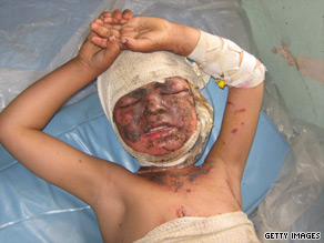 Afghanistan War Casualties Pictures