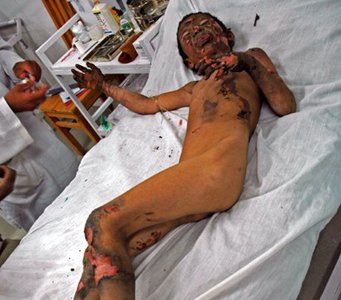 Afghanistan War Casualties Pictures