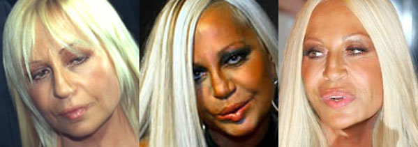 Donatella Versace Before Plastic Surgery